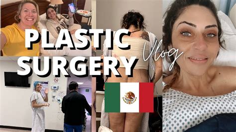 tijuana tummy tuck cost|Tummy Tuck in Tijuana – Mexico